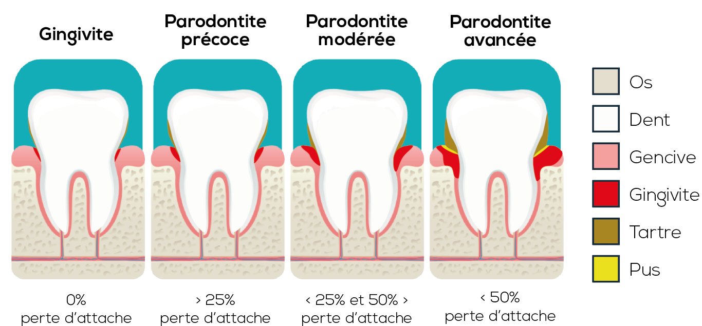 dents